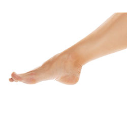 Поперечное плоскостопие: обувь или стельки?