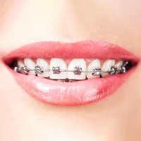 Зубна щітка President Orthodontic