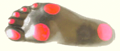 Діабетична взуття EPUR RUDO WELCRO, зображення - 3