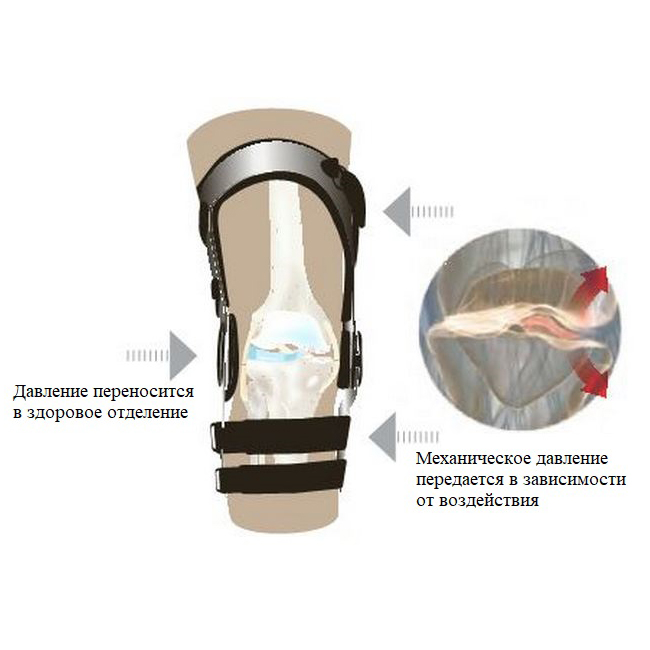 Ортез на коліно OA NANO арт. 11-1215/11-1217 DONJOY, зображення - 1