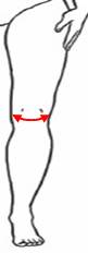 Наколінник для фіксації коліна К-1ТМ (S-XXXL) Реабілітімед, зображення - 1