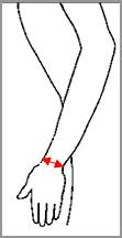 Ортез на променево-зап'ястковий суглоб з ребрами жорсткості 8551 Med textile, (Україна), зображення - 1