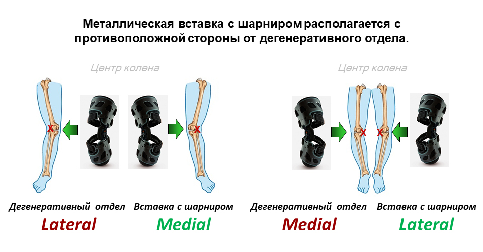 Функциональный ортез сгибательно-разгибательный OCR300 UNI Orliman, изображение - 1