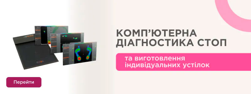 Діагностика стоп