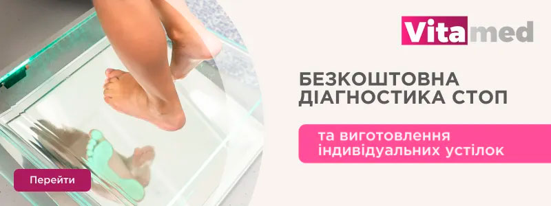 Діагностика стоп та виготовлення устілок Vitamed